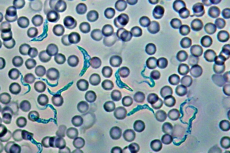 Trypanosoma gambiense in blood smear