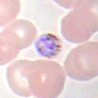 Plasmodium