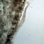 Spirostomum