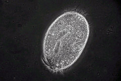 Oxytricha in phase contrast