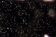 Yogurt bacteria in darkfield illumination